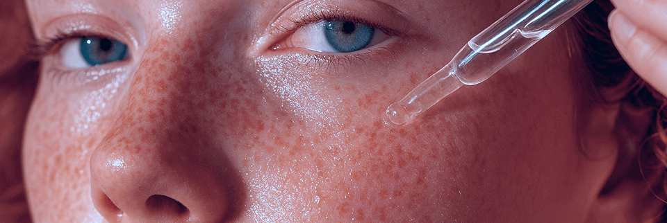 Cosmética para Profesionales Chica pelirroja aplicando tratamiento facial