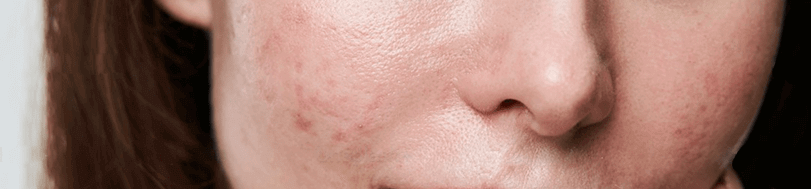 Productos Bayo Profesional